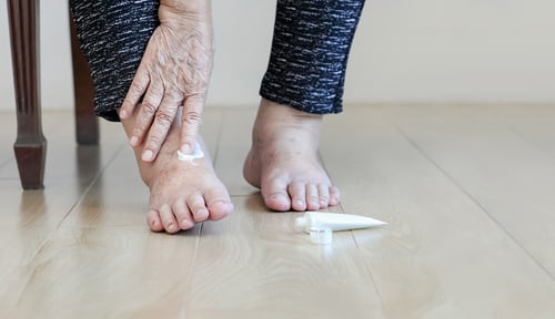 elderly-woman-putting-cream-swollen-feet